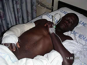 Naison Mashambanaka the young man who was shot by police in the early hours of yesterday morning at the funeral of Gift Tandare.