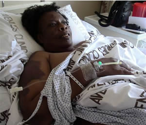 Sekai Holland, MDC Secretary for Research and Policy sustained multiple deep tissue bruising as can be seen from these photographs, fractured left arm, left leg and some ribs. She is 64 years of age.