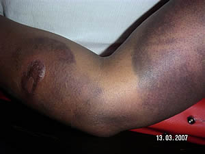 Grace Kwinjeh - left arm