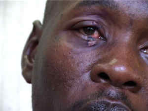 Mar 7, 2002 - AM was assaulted using sticks, hose pipes, hands and booted feet. One of the assailants burnt him on the eyelid with a cigarette