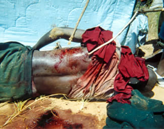 Tapiwa Mubwanda's body and stab wounds