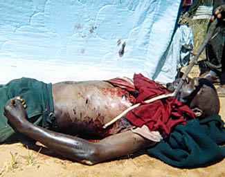 Tapiwa Mubwanda's body and stab wounds