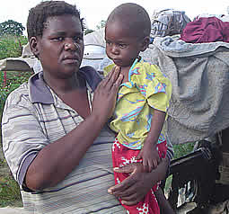 Fungai Katsande hold her baby Nyasha who suffers from Marasmus