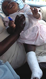 This baby sustained a broken leg when her mother was being beaten by the riot police.